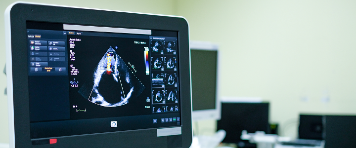 Echocardiography