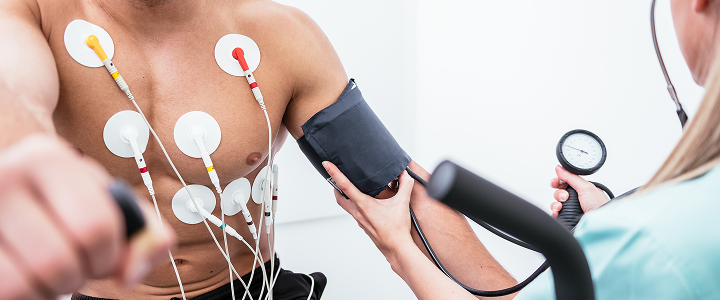 Stress Echocardiography